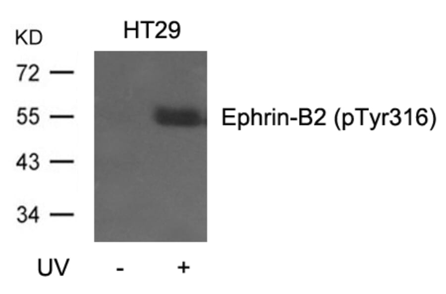 Western blot - Ephrin-B2 (Phospho-Tyr316) Antibody from Signalway Antibody (11188) - Antibodies.com