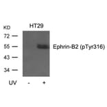 Western blot - Ephrin-B2 (Phospho-Tyr316) Antibody from Signalway Antibody (11188) - Antibodies.com