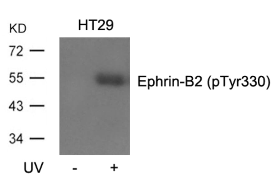 Western blot - Ephrin-B2 (Phospho-Tyr330) Antibody from Signalway Antibody (11189) - Antibodies.com
