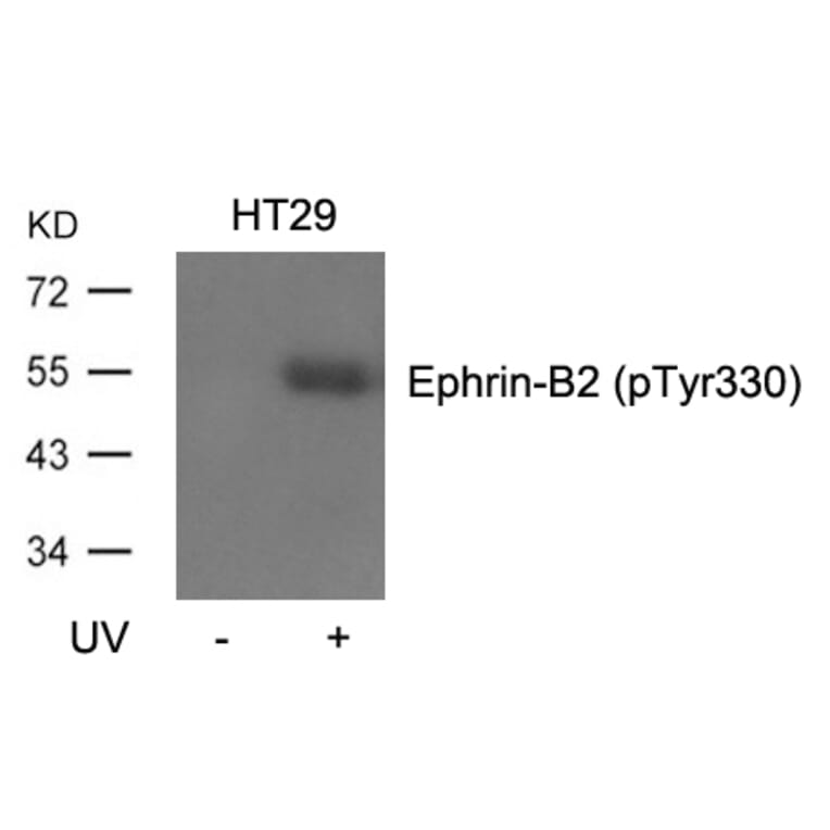 Western blot - Ephrin-B2 (Phospho-Tyr330) Antibody from Signalway Antibody (11189) - Antibodies.com