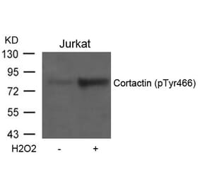 Western blot - Cortactin (Phospho-Tyr466) Antibody from Signalway Antibody (11272) - Antibodies.com