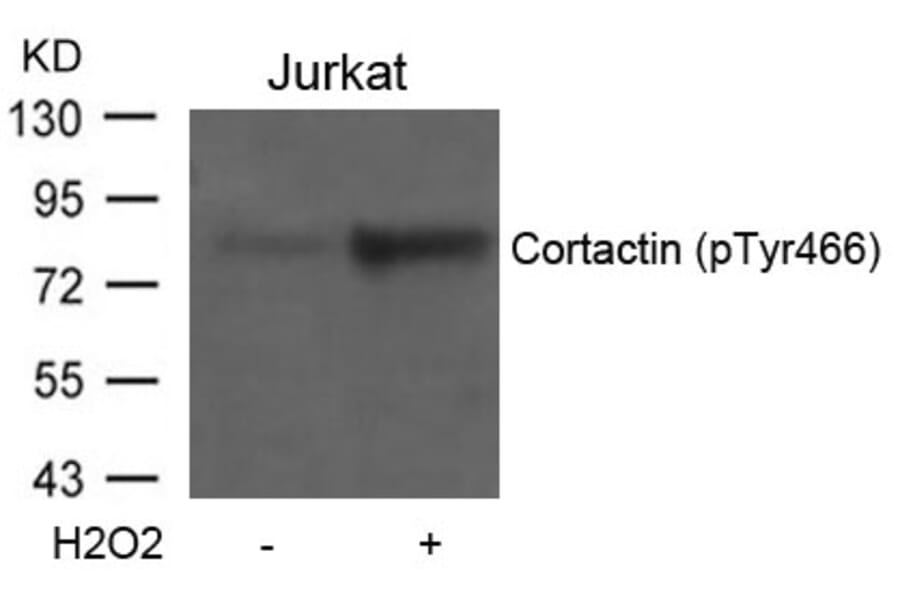 Western blot - Cortactin (Phospho-Tyr466) Antibody from Signalway Antibody (11272) - Antibodies.com