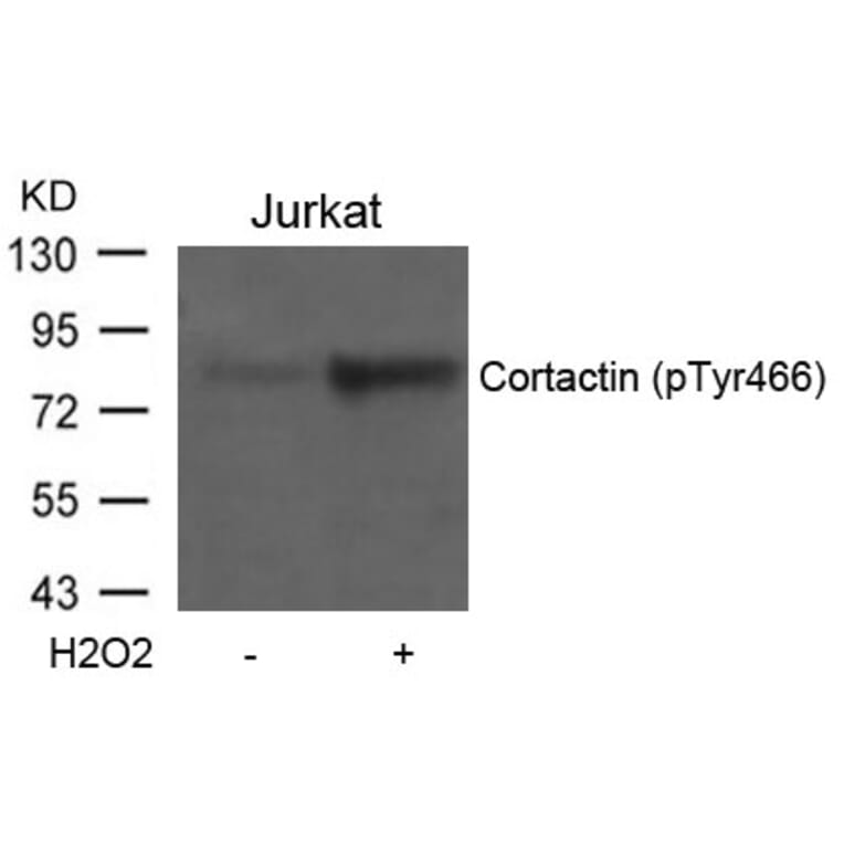 Western blot - Cortactin (Phospho-Tyr466) Antibody from Signalway Antibody (11272) - Antibodies.com