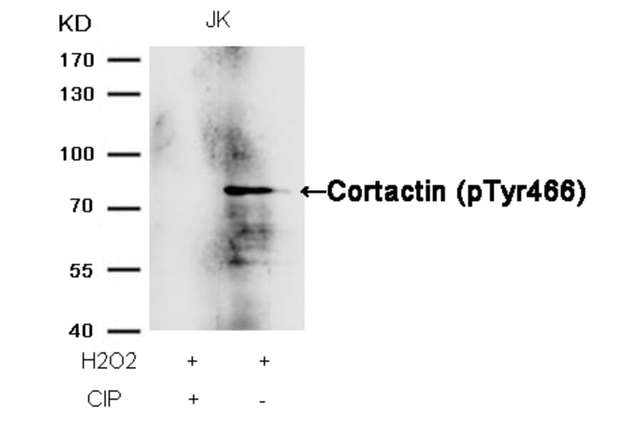 Western blot - Cortactin (Phospho-Tyr466) Antibody from Signalway Antibody (11272) - Antibodies.com