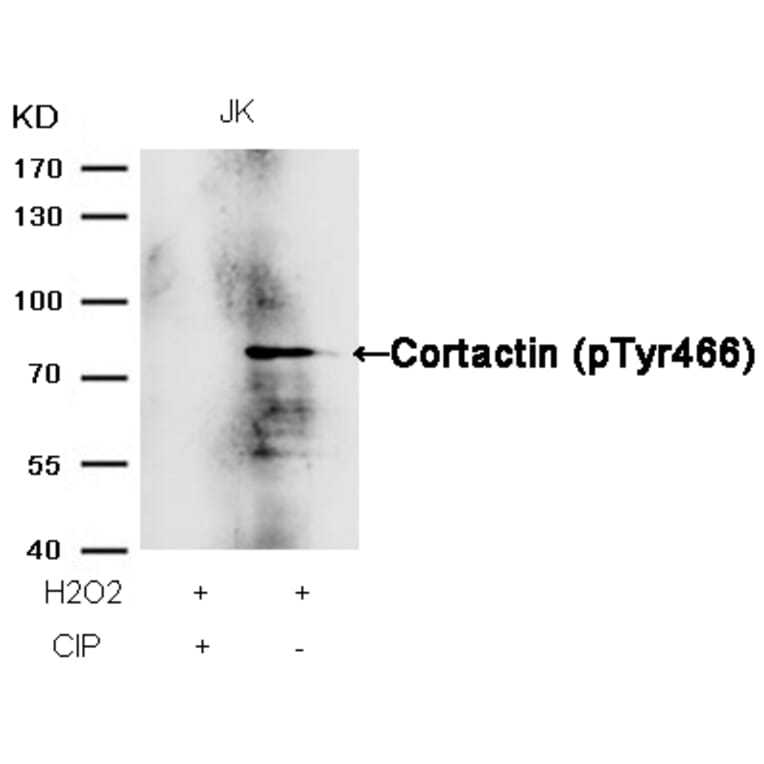 Western blot - Cortactin (Phospho-Tyr466) Antibody from Signalway Antibody (11272) - Antibodies.com