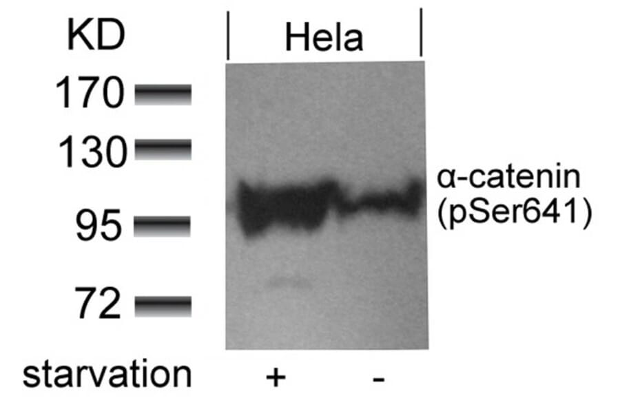 Western blot - a-catenin (Phospho-Ser641) Antibody from Signalway Antibody (11330) - Antibodies.com
