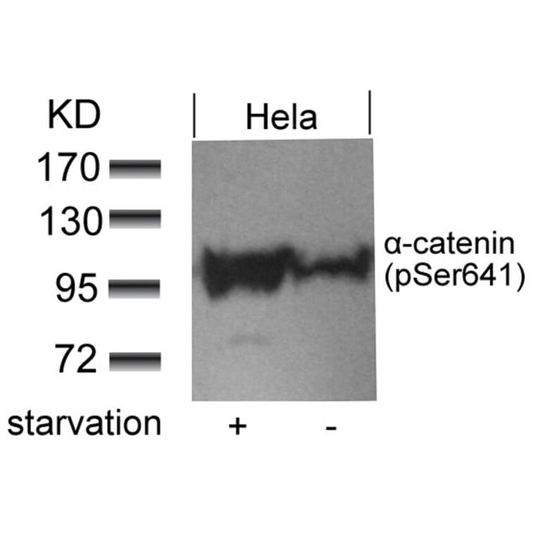 Western blot - a-catenin (Phospho-Ser641) Antibody from Signalway Antibody (11330) - Antibodies.com