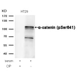 Western blot - a-catenin (Phospho-Ser641) Antibody from Signalway Antibody (11330) - Antibodies.com