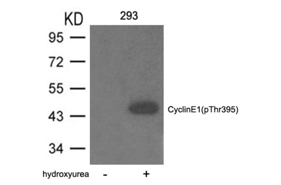 Western blot - Cyclin E1 (phospho-Thr395) Antibody from Signalway Antibody (11541) - Antibodies.com