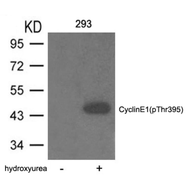Western blot - Cyclin E1 (phospho-Thr395) Antibody from Signalway Antibody (11541) - Antibodies.com