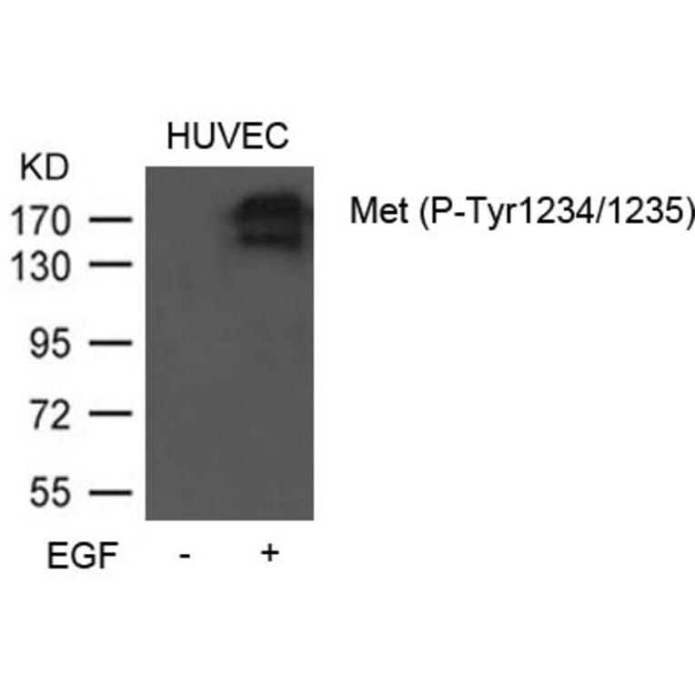 Western blot - Met (Phospho-Tyr1234/1235) Antibody from Signalway Antibody (11585) - Antibodies.com