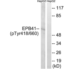 Western blot - EPB41 (Phospho-Tyr660/418) Antibody from Signalway Antibody (11799) - Antibodies.com