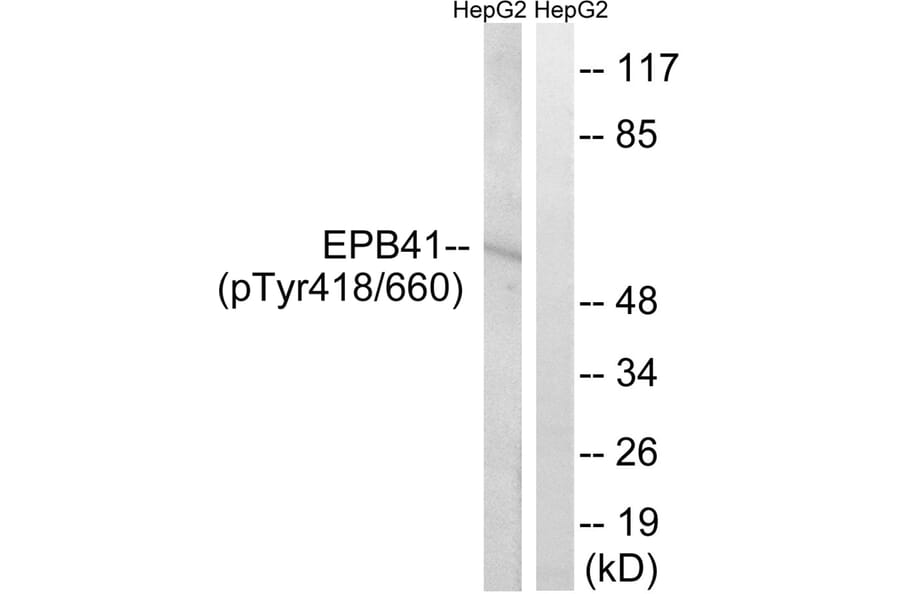 Western blot - EPB41 (Phospho-Tyr660/418) Antibody from Signalway Antibody (11799) - Antibodies.com