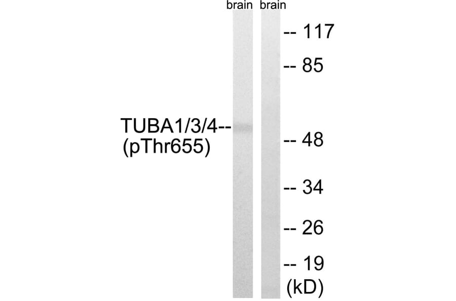 Western blot - TUBA1/3/4 (Phospho-Tyr272) Antibody from Signalway Antibody (11829) - Antibodies.com