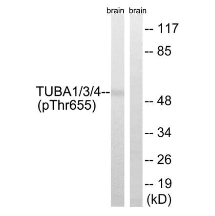 Western blot - TUBA1/3/4 (Phospho-Tyr272) Antibody from Signalway Antibody (11829) - Antibodies.com