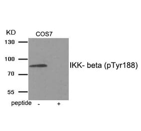 Western blot - IKK- beta (Phospho-Tyr188) Antibody from Signalway Antibody (11929) - Antibodies.com
