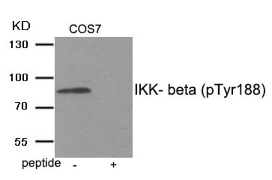 Western blot - IKK- beta (Phospho-Tyr188) Antibody from Signalway Antibody (11929) - Antibodies.com