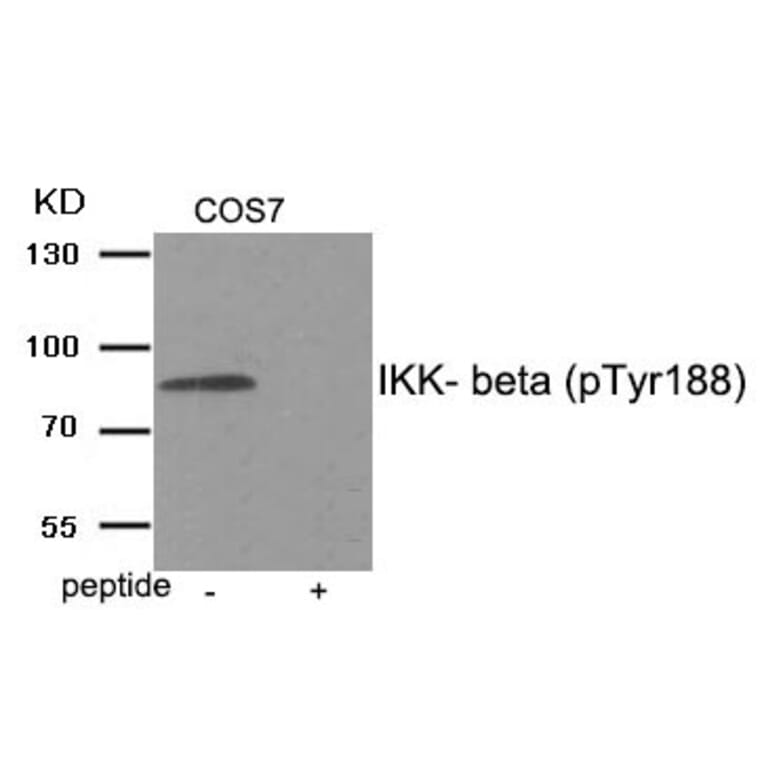 Western blot - IKK- beta (Phospho-Tyr188) Antibody from Signalway Antibody (11929) - Antibodies.com