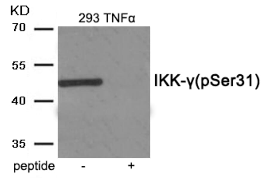 Western blot - IKK- gamma (Phospho-Ser31) Antibody from Signalway Antibody (11967) - Antibodies.com