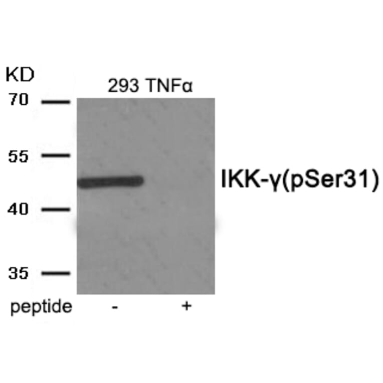 Western blot - IKK- gamma (Phospho-Ser31) Antibody from Signalway Antibody (11967) - Antibodies.com