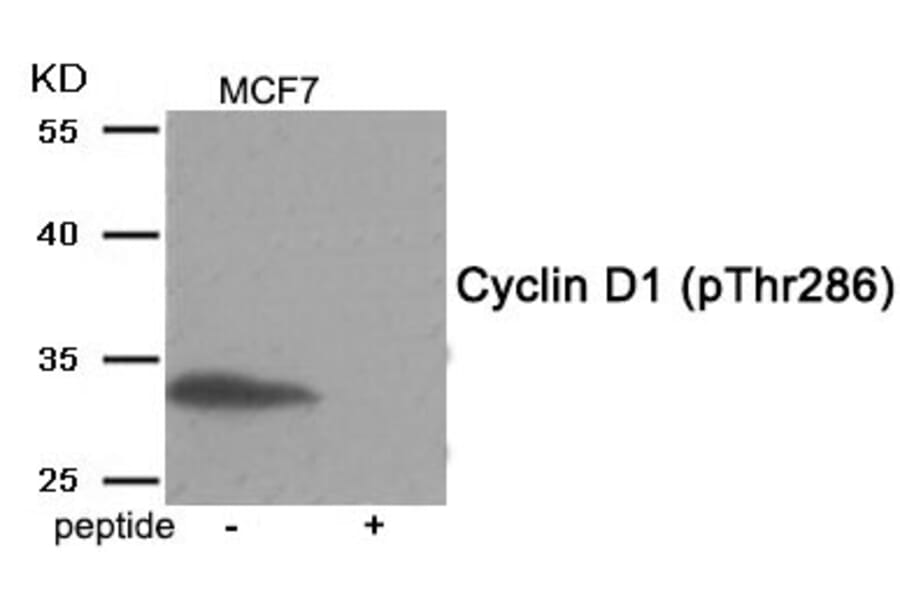 Western blot - Cyclin D1 (Phospho-Thr286) Antibody from Signalway Antibody (11968) - Antibodies.com