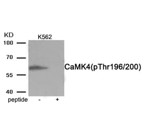 Western blot - CaMK4 (Phospho-Thr196/200) Antibody from Signalway Antibody (11981) - Antibodies.com