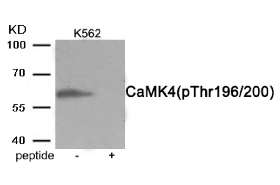 Western blot - CaMK4 (Phospho-Thr196/200) Antibody from Signalway Antibody (11981) - Antibodies.com