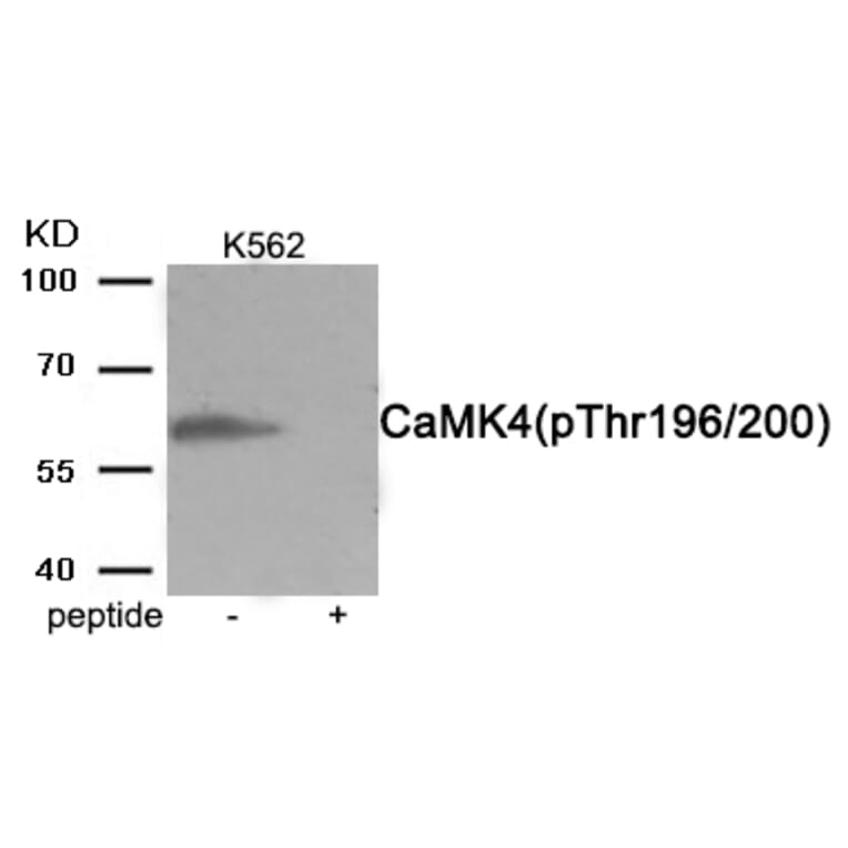 Western blot - CaMK4 (Phospho-Thr196/200) Antibody from Signalway Antibody (11981) - Antibodies.com