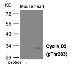Western blot - Cyclin D3 (Phospho-Thr283) Antibody from Signalway Antibody (12004) - Antibodies.com