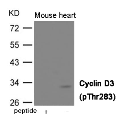 Western blot - Cyclin D3 (Phospho-Thr283) Antibody from Signalway Antibody (12004) - Antibodies.com