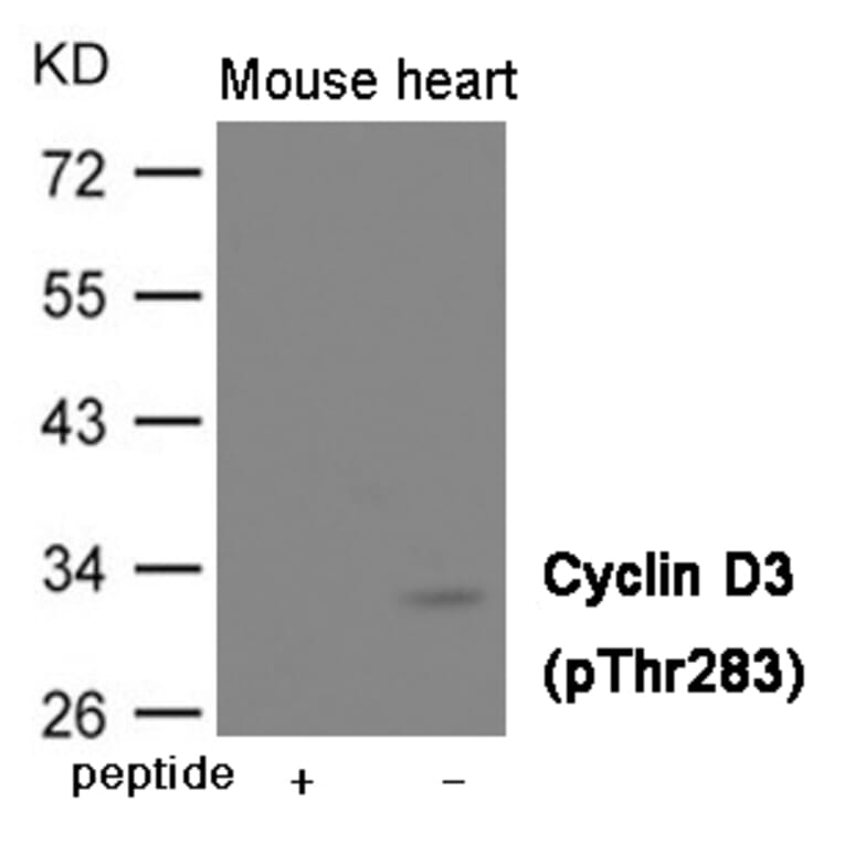 Western blot - Cyclin D3 (Phospho-Thr283) Antibody from Signalway Antibody (12004) - Antibodies.com
