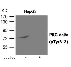 Western blot - PKC delta (Phospho-Tyr313) Antibody from Signalway Antibody (12032) - Antibodies.com