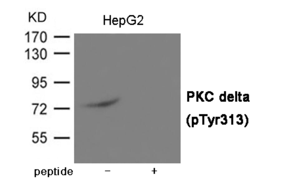Western blot - PKC delta (Phospho-Tyr313) Antibody from Signalway Antibody (12032) - Antibodies.com