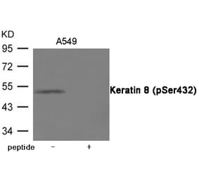Western blot - Keratin 8 (Phospho-Ser432) Antibody from Signalway Antibody (12042) - Antibodies.com