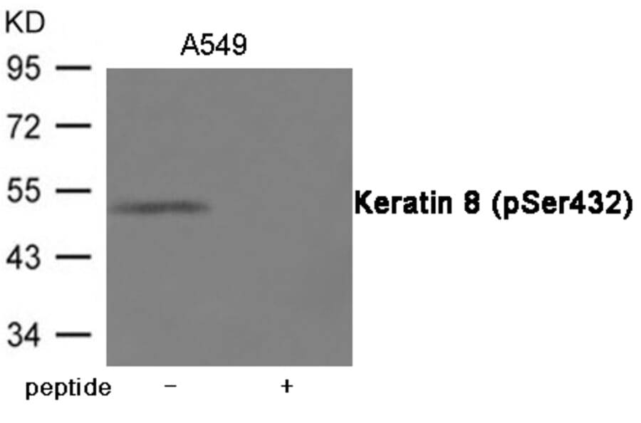 Western blot - Keratin 8 (Phospho-Ser432) Antibody from Signalway Antibody (12042) - Antibodies.com