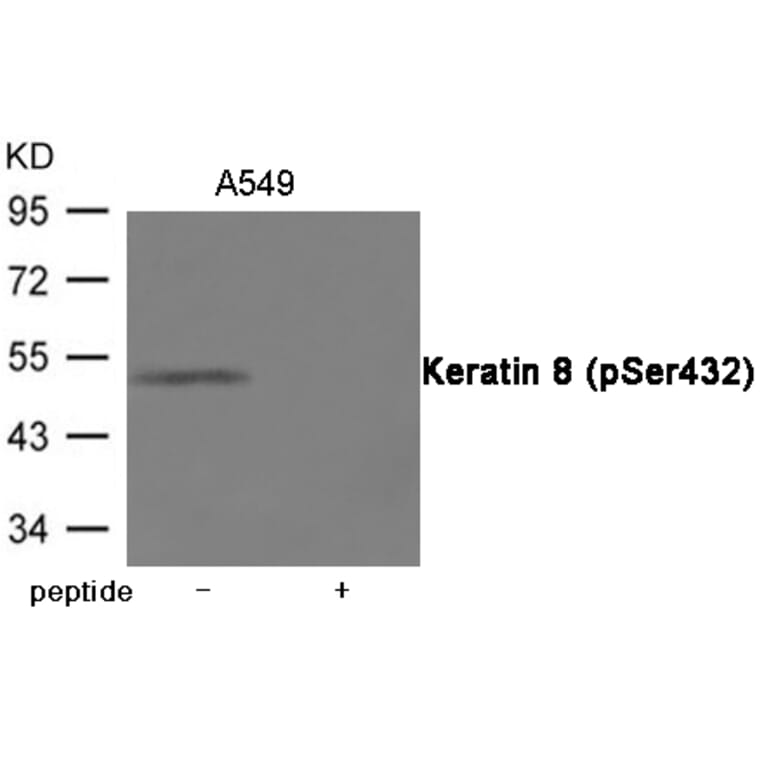 Western blot - Keratin 8 (Phospho-Ser432) Antibody from Signalway Antibody (12042) - Antibodies.com
