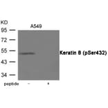 Western blot - Keratin 8 (Phospho-Ser432) Antibody from Signalway Antibody (12042) - Antibodies.com
