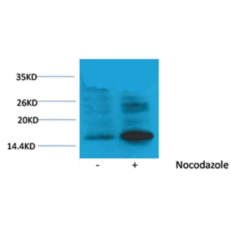 Western blot - Histone H3 (Phospho-Thr118) Rabbit Polyclonal Antibody from Signalway Antibody - Antibodies.com