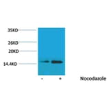 Western blot - Histone H2B (Phospho-Ser32) Rabbit Polyclonal Antibody from Signalway Antibody - Antibodies.com