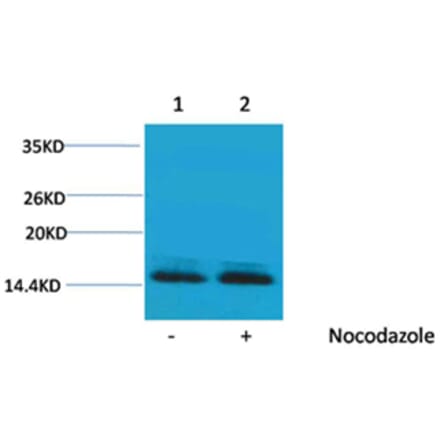 Western blot - Histone H2B (Phospho-Ser14) Rabbit Polyclonal Antibody from Signalway Antibody - Antibodies.com