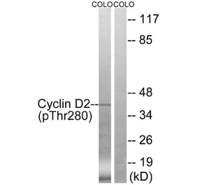 Western blot - Cyclin D2 (Phospho-Thr280) Antibody from Signalway Antibody (12122) - Antibodies.com