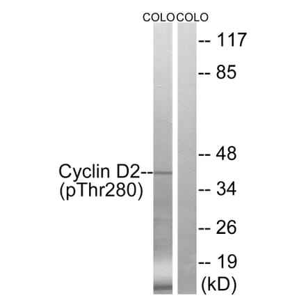 Western blot - Cyclin D2 (Phospho-Thr280) Antibody from Signalway Antibody (12122) - Antibodies.com