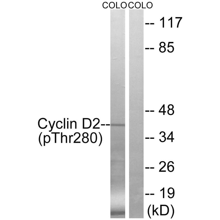 Western blot - Cyclin D2 (Phospho-Thr280) Antibody from Signalway Antibody (12122) - Antibodies.com