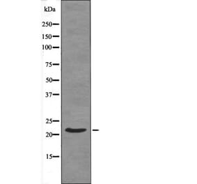 Western blot - Syndecan4 (Phospho-Ser179) Antibody from Signalway Antibody (12438) - Antibodies.com