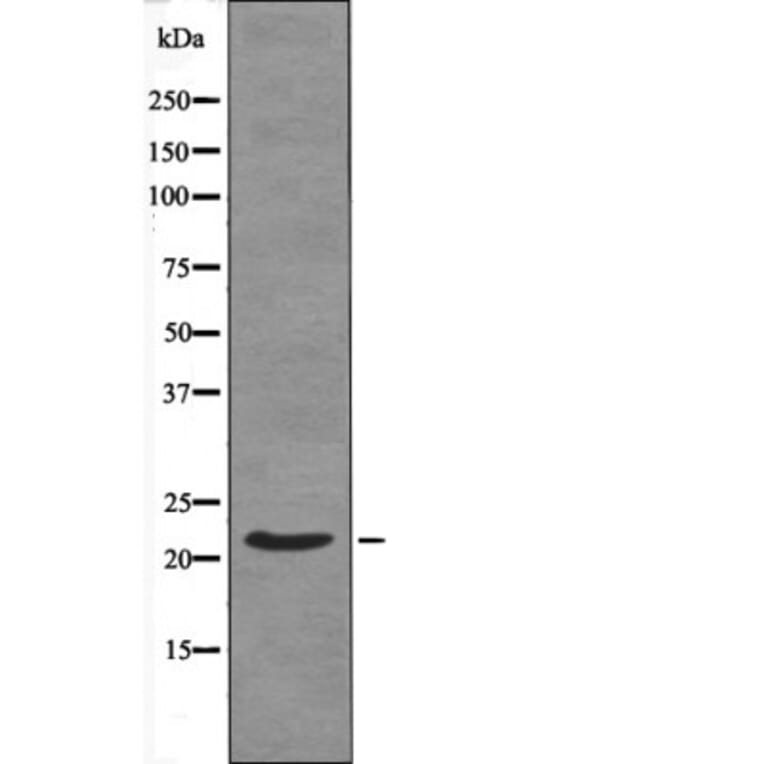 Western blot - Syndecan4 (Phospho-Ser179) Antibody from Signalway Antibody (12438) - Antibodies.com