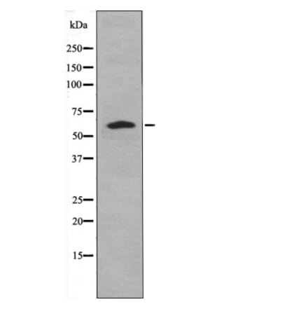 Western blot - Caspase 8 (Phospho-Tyr448) Antibody from Signalway Antibody (12467) - Antibodies.com