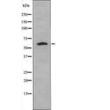 Western blot - Caspase 8 (Phospho-Tyr448) Antibody from Signalway Antibody (12467) - Antibodies.com