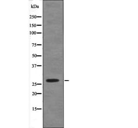 Western blot - Caveolin 2 (Phospho-Ser23) Antibody from Signalway Antibody (12468) - Antibodies.com
