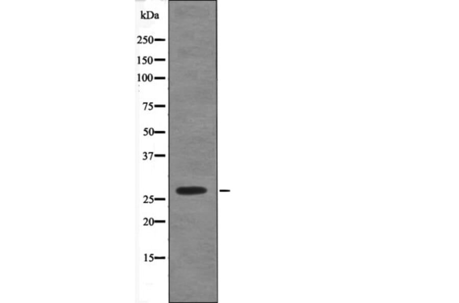 Western blot - Caveolin 2 (Phospho-Ser23) Antibody from Signalway Antibody (12468) - Antibodies.com