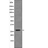 Western blot - Caveolin 2 (Phospho-Ser23) Antibody from Signalway Antibody (12468) - Antibodies.com